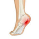 Relieves heel, knee & back pain